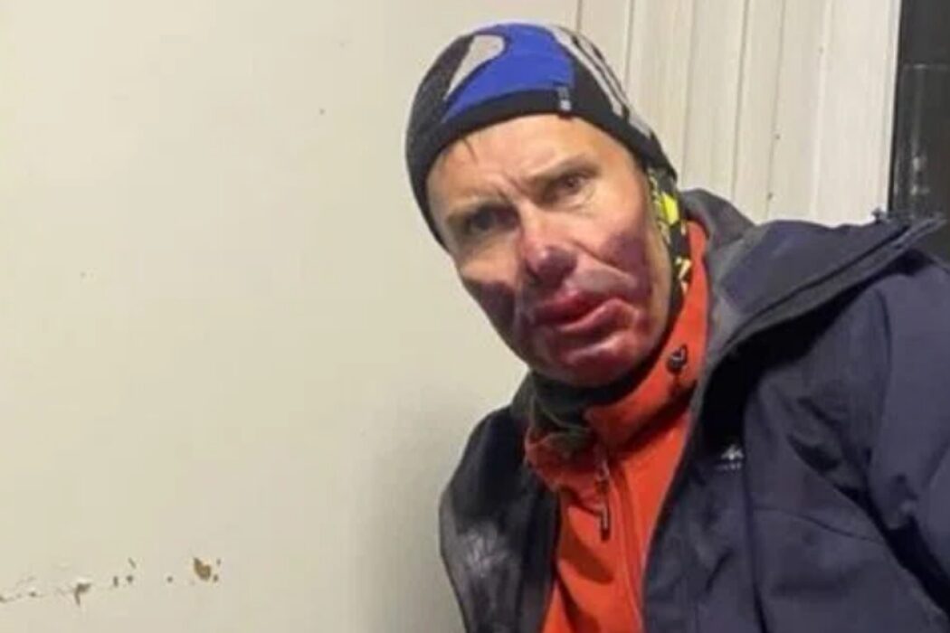 Орчанин Антон Никифоров, выполнявший восхождение на Эльбрус с группой туристов, госпитализирован с обморожением